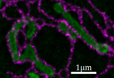 Figure 1: STED image (deconvolved) of mitochondria (green) and endoplasmic reticulum (magenta) in a living cell.