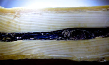 A sectioned narwhal tusk revealing annual growth layers of which we can extract information on elements, isotopes, 14Carbon and hormones.